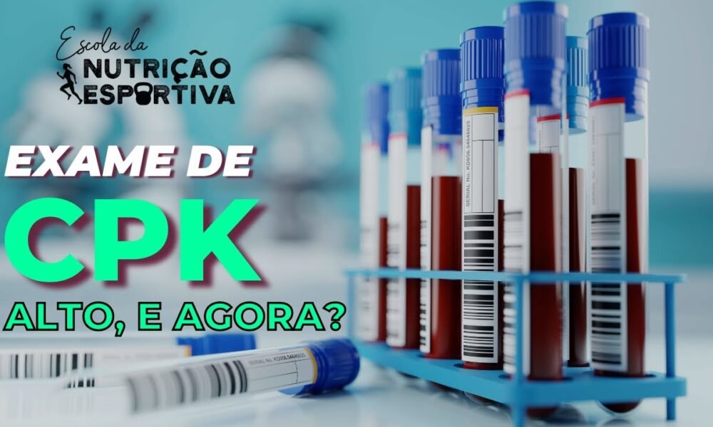 Exame CPK alto: como diferenciar Exercício físico x Complicação ...